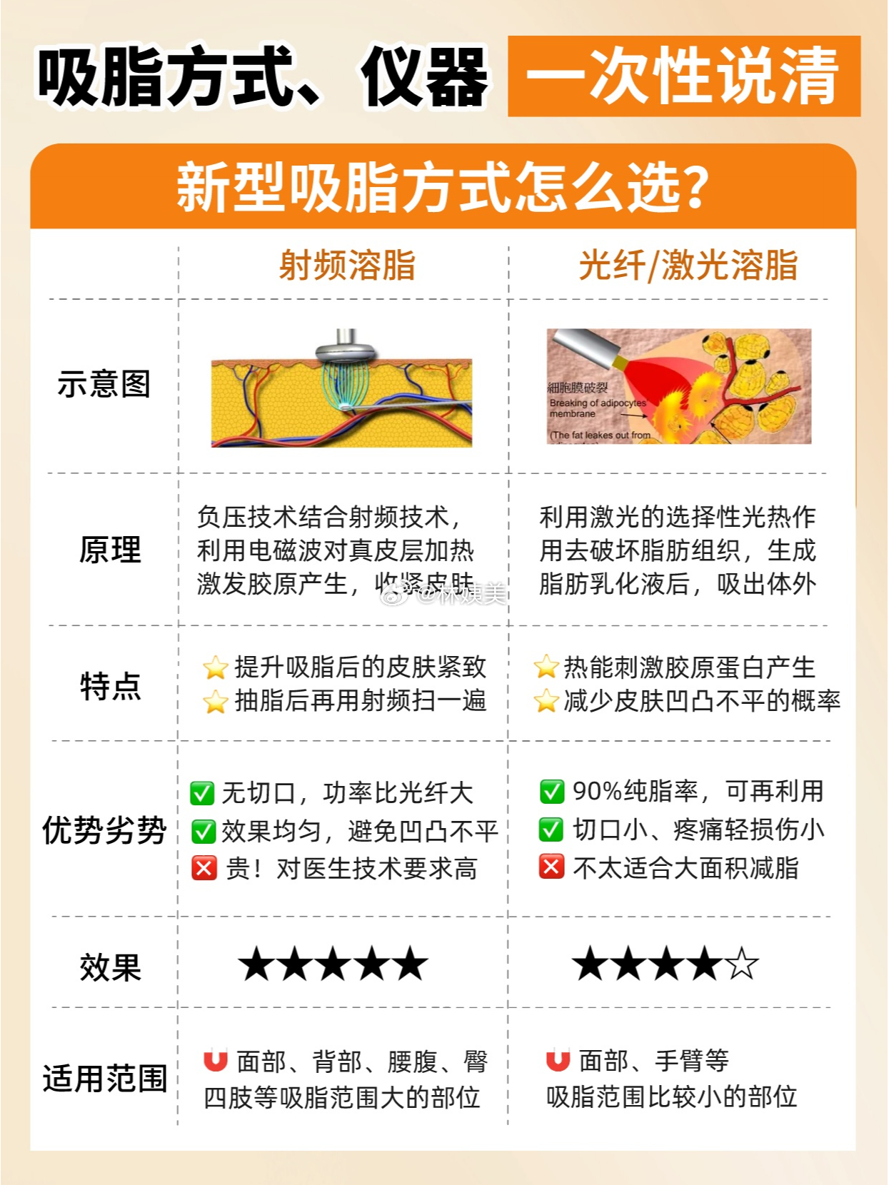 最新吸脂方法解析，轻松实现理想身材！